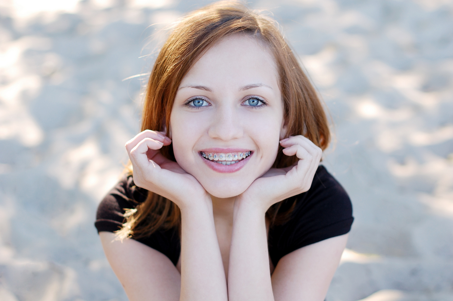 braces-teenager-image